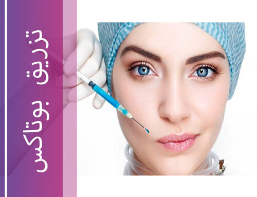 تزریق بوتاکس