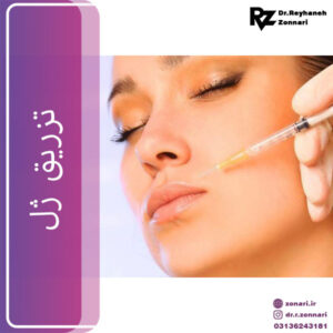 تزریق ژل - دکتر زناری