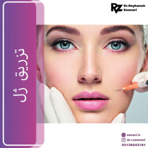 تزریق ژل - دکتر زناری