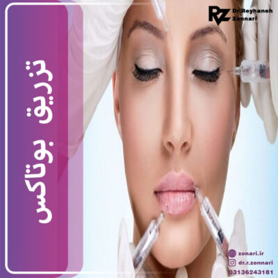 تزریق بوتاکس - دکتر زناری