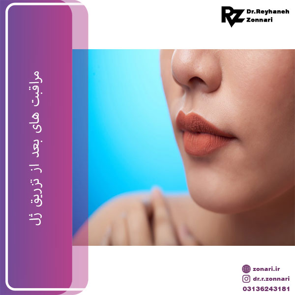 مراقبت های بعد از تزریق ژل
