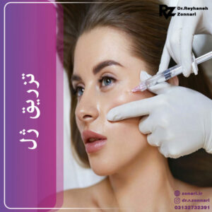 تزریق ژل - دکتر زناری