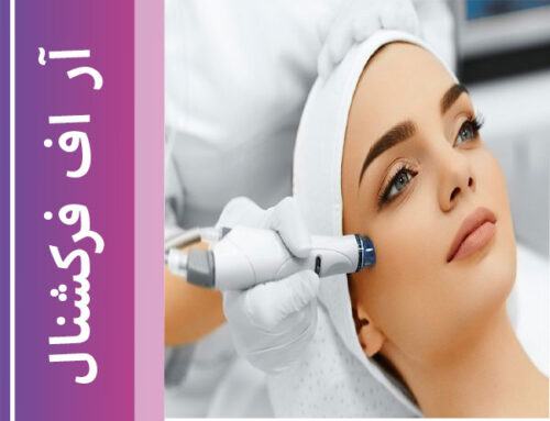 آر اف فرکشنال