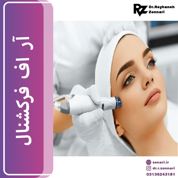 آر اف فرکشنال