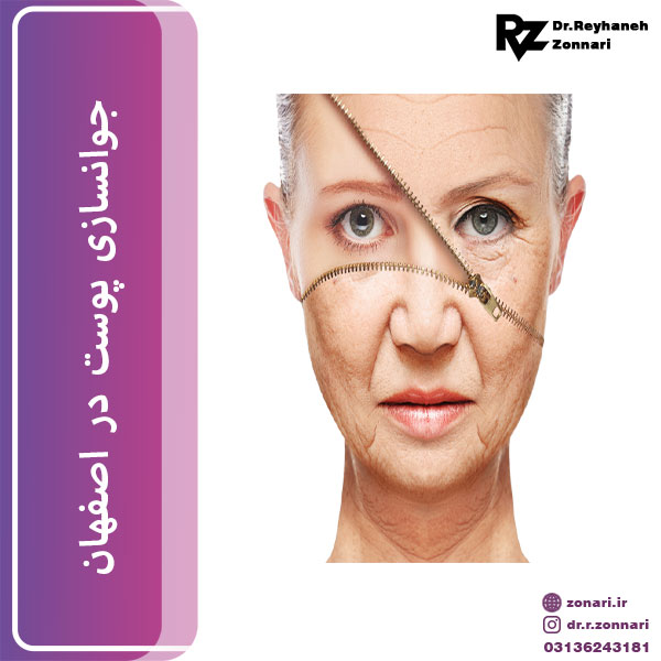جوانسازی پوست در اصفهان