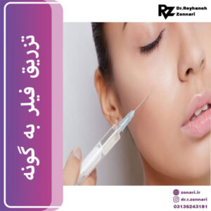 تزریق فیلر به گونه - دکتر زناری