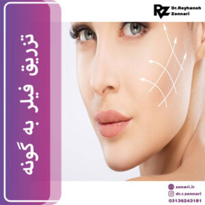 تزریق فیلر به گونه