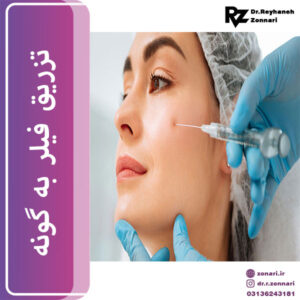 تزریق فیلر به گونه - دکتر زناری