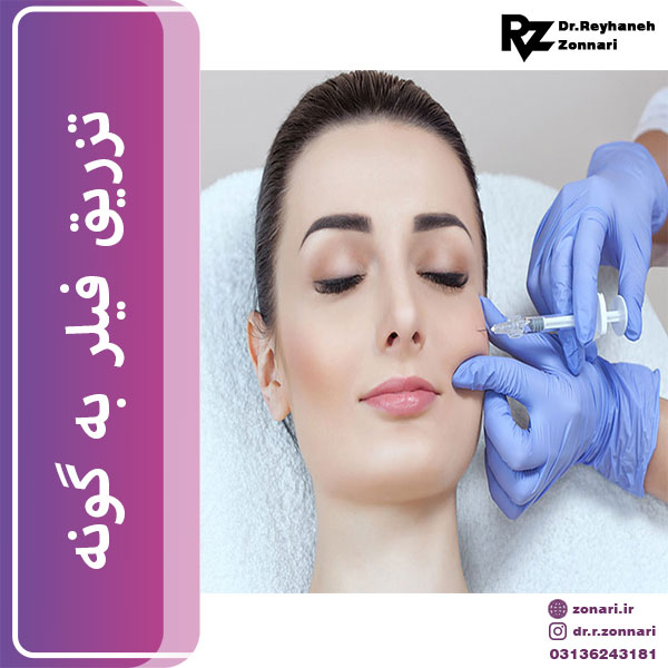 تزریق فیلر به گونه