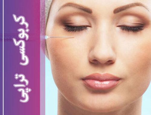 کربوکسی تراپی