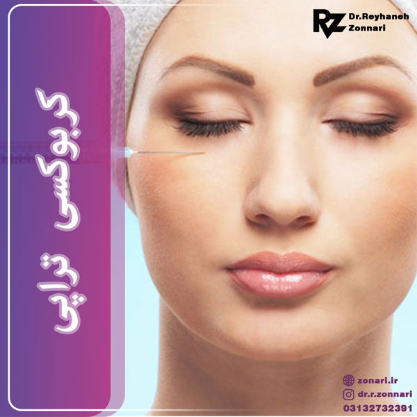 کربوکسی تراپی