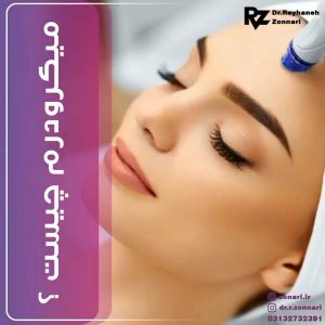 میکرودرم ابریژن