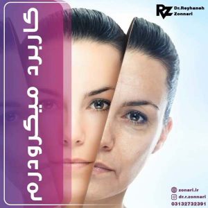 میکرودرم ابریژن
