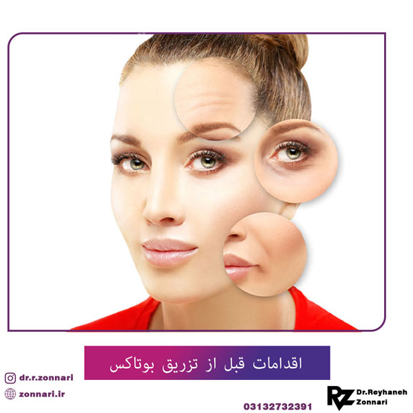 اقدامات قبل از تزریق بوتاکس