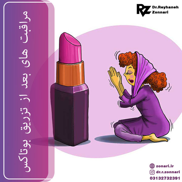 مراقبت های بعد از تزریق بوتاکس