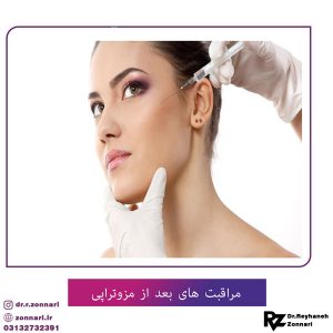 مراقبت های بعد از مزوتراپی