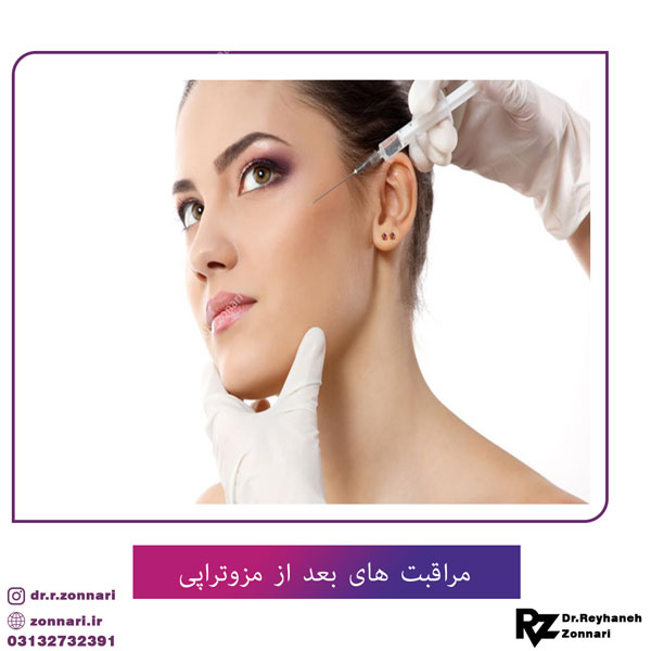 مراقبت های بعد از مزوتراپی