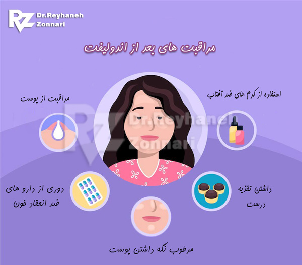 مراقبت های بعد از اندولیفت