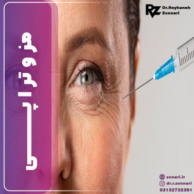 مزوتراپی -دکتر زناری